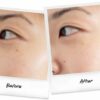 ก่อน-หลัง kiehl's คีลส์ Dark Spot Solution (3)